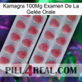 Kamagra 100Mg Examen De La Gelée Orale 19